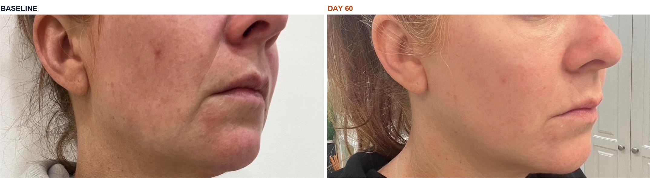 Jessica B. before and after