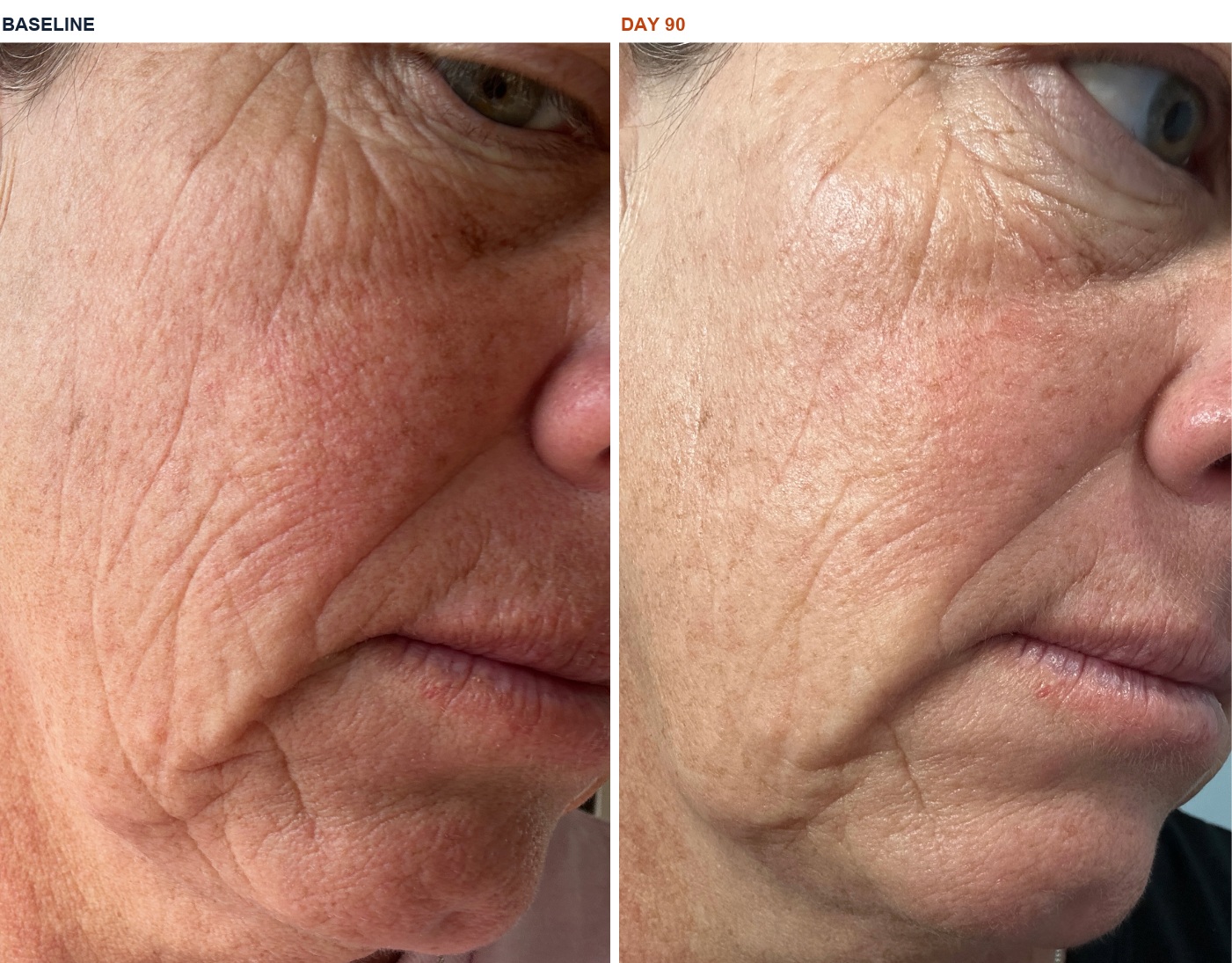 Gina G. before and after